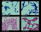 bacteria microscopy